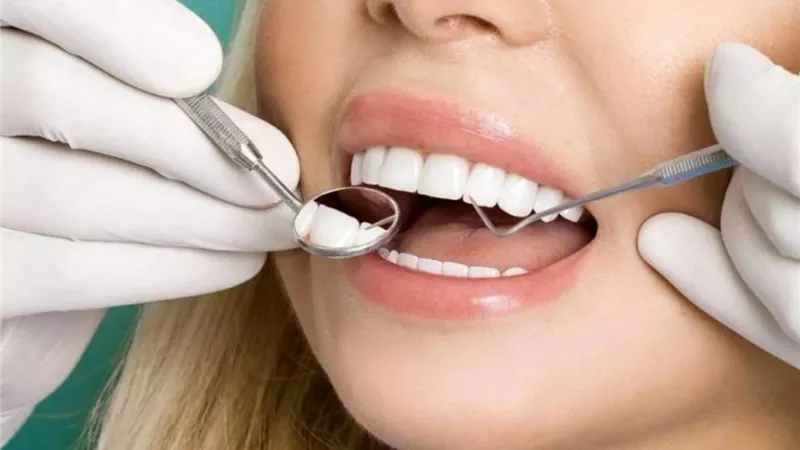 6 طرق للوقاية من تسوس الأسنان.. منها اتباع نظام غذائي صحي 