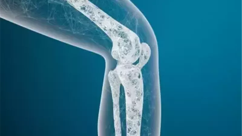 في اليوم العالمي لهشاشة العظام.. إليك أبرز أسبابه وأهم أعراضه 