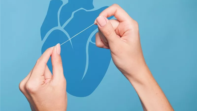 استخدام خيط تنظيف الأسنان مرة في الأسبوع قد يقلل من خطر السكتات الدماغية