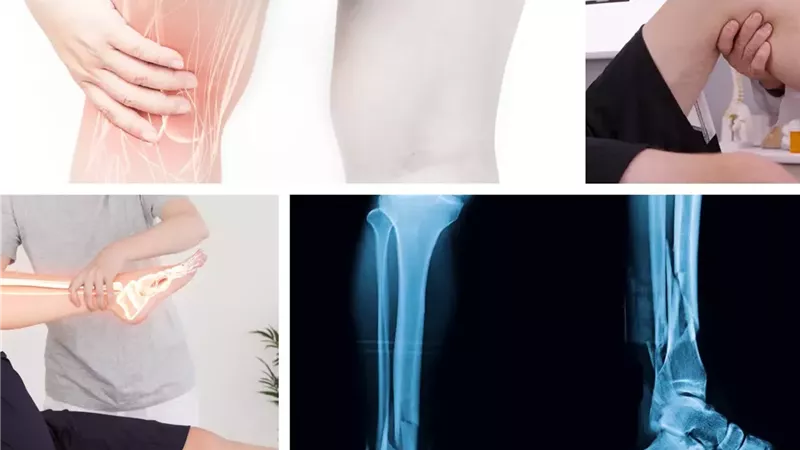 7 علامات تحذيرية لمشاكل صحية يمكن رؤيتها في الساقين 