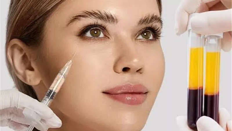  الفيلر الحيوي Bio-Filler: علاج تجميلي آمن يستمد فعاليته من جسمك