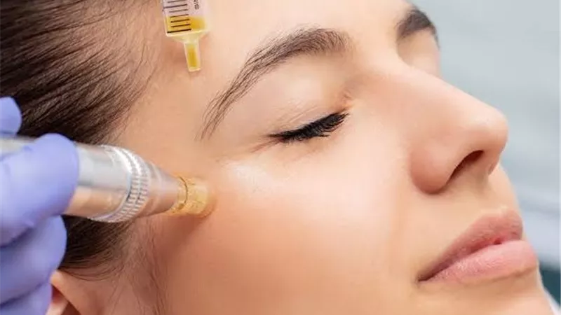  النانوفات.. تقنية تجميلية ثورية تعيد شباب البشرة بخلايا الجسم الذاتية