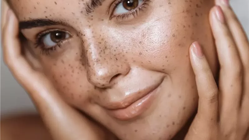 ما هو حمض اللاكتيك.. وكيف يمكن استخدامه لتعزيز نضارة بشرتك؟