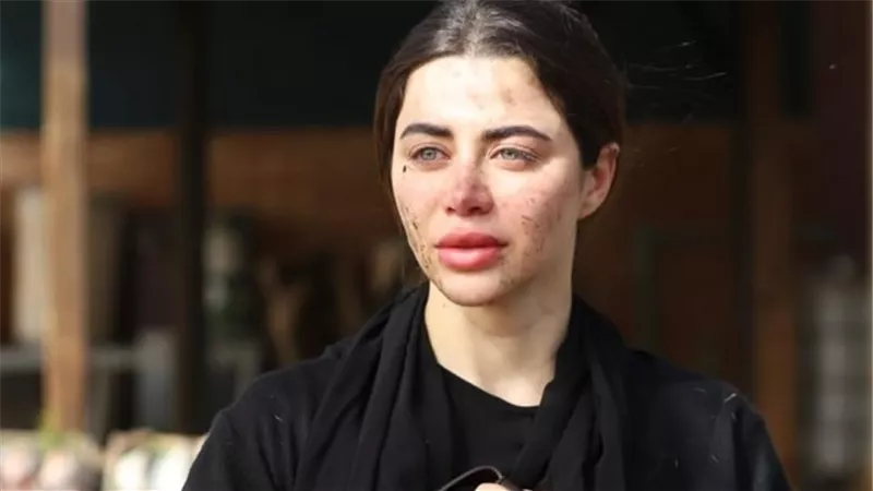 يارا السكري تتعرض للضرب والغيرة تشتعل في قلب درة في الحلقة 16 من 
